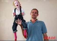  罕见！迷你“拇指姑娘”身高仅68厘米 